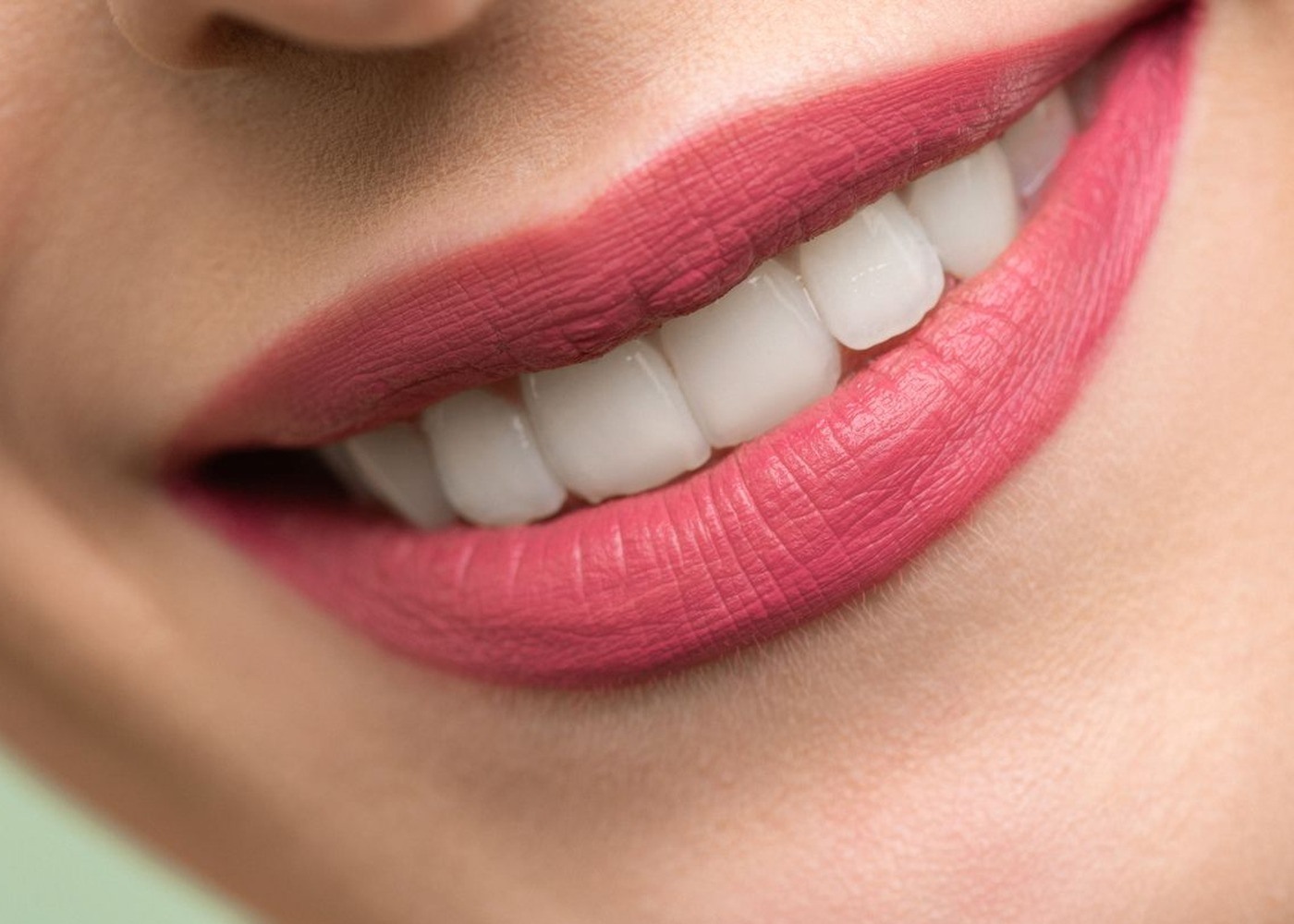 Smile after braces