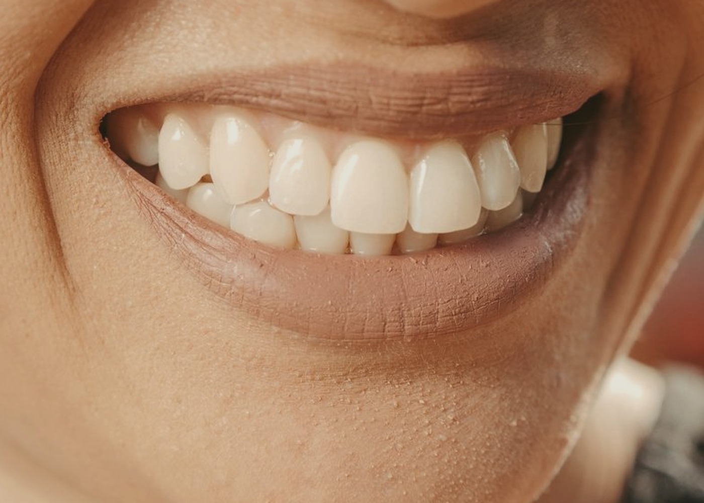 Smile before cosmetic dentistry