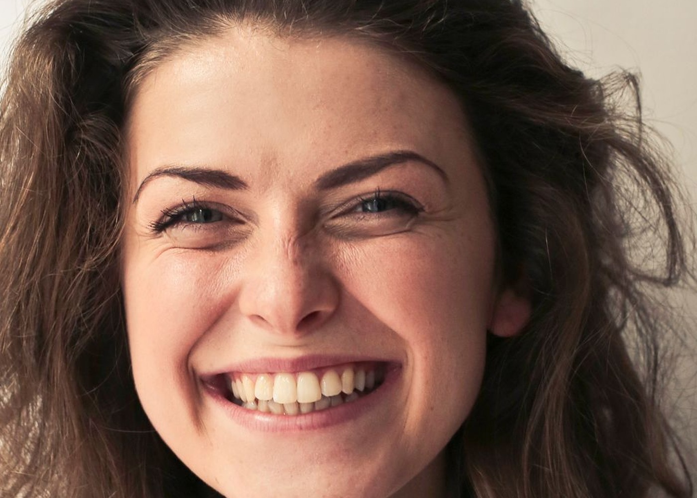 Smile after Invisalign