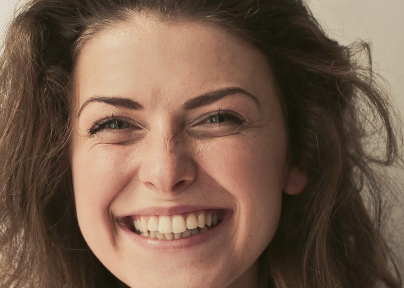 Smile before Invisalign