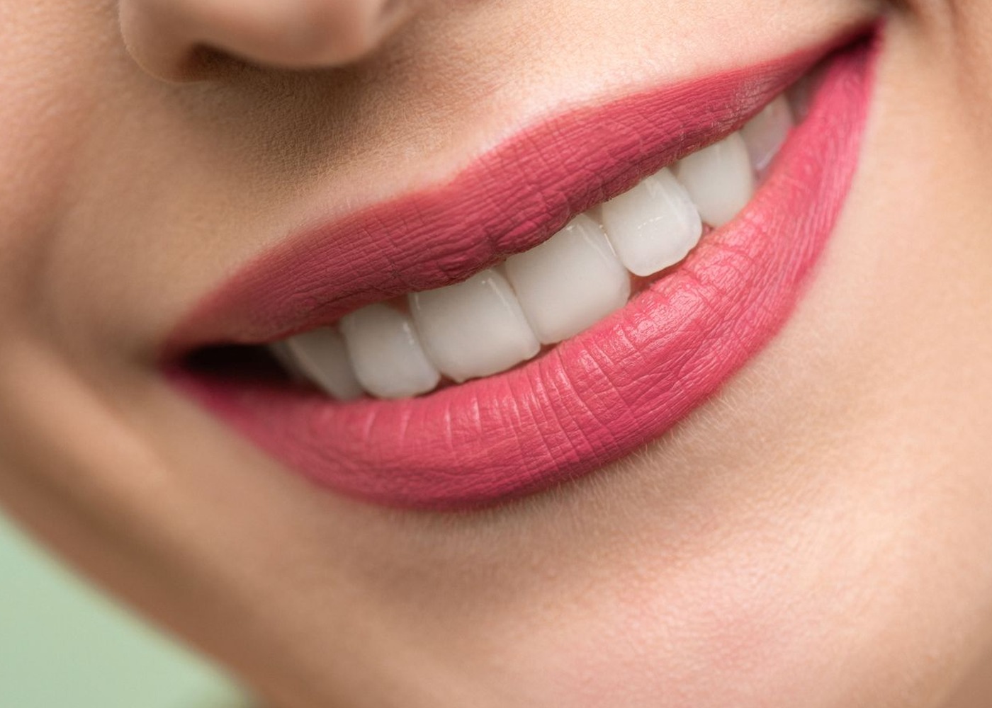 Smile after veneers